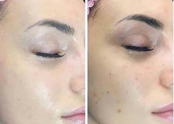 Inelz review- we tried it!