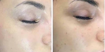 Inelz review- we tried it!