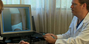 Top 7 Reasons to Choose Liposuction