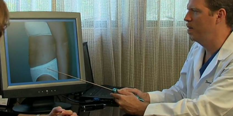 Top 7 Reasons to Choose Liposuction